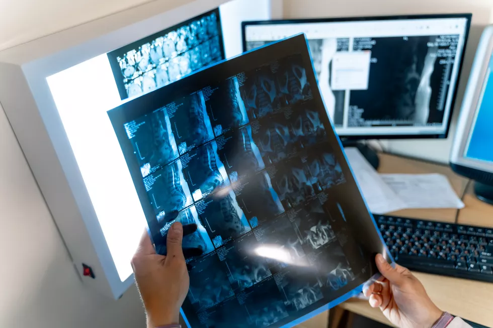 healthcare-medical-radiology-concept-doctors-looking-x-ray-selective-focus-hands