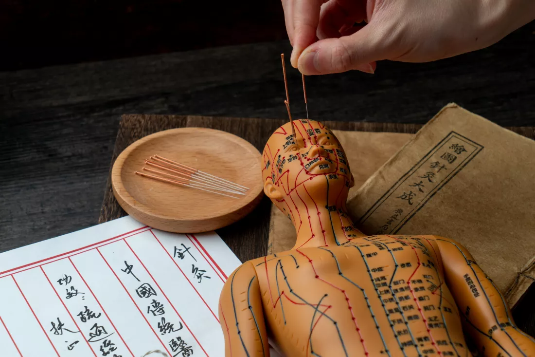 acupuncture-models-medical-books-are-table-acupuncture-is-traditional-chinese-medical-method(1)