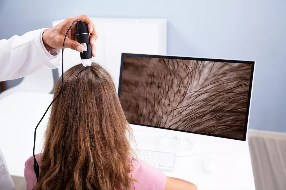 dermatologist-using-trichoscope-hair-fall-treatment