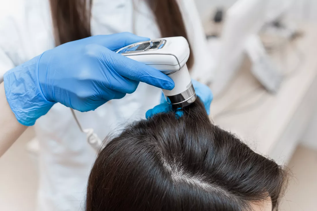 trichoscopy-woman-s-head-with-trichoscope-close-up